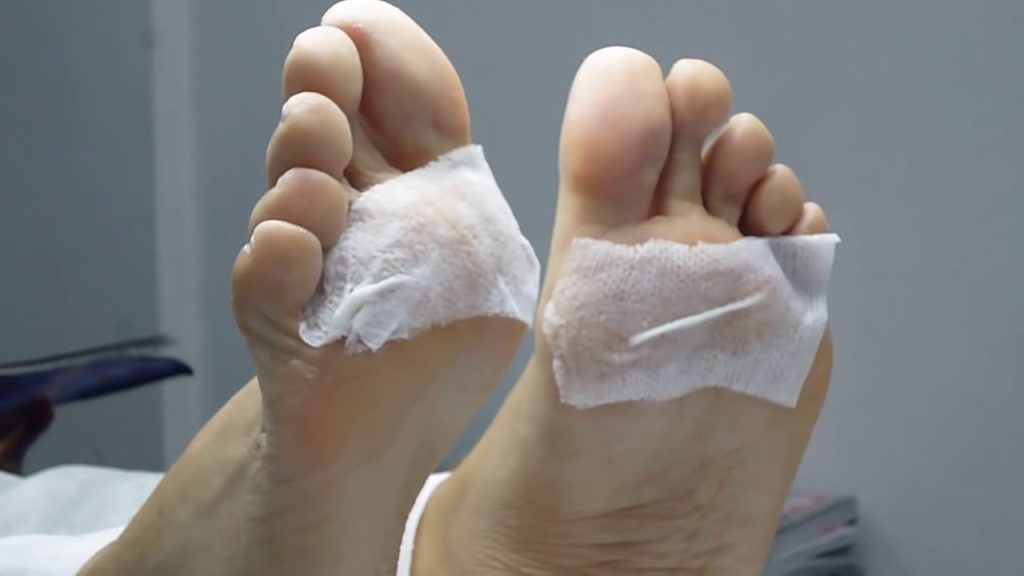 Esto es lo que debes hacer si pisas un clavo en la calle 186 Primeros auxilios cuando pisas sobre un clavo