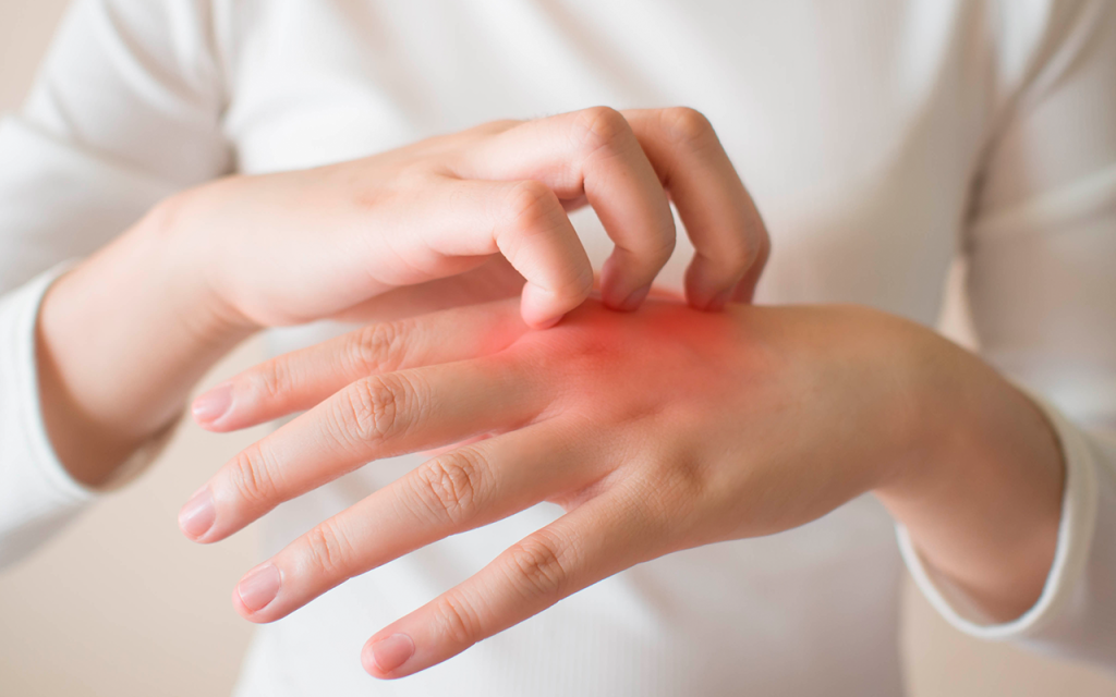 Problemas de piel que tendrás con la diabetes 46 Infecciones bacterianas