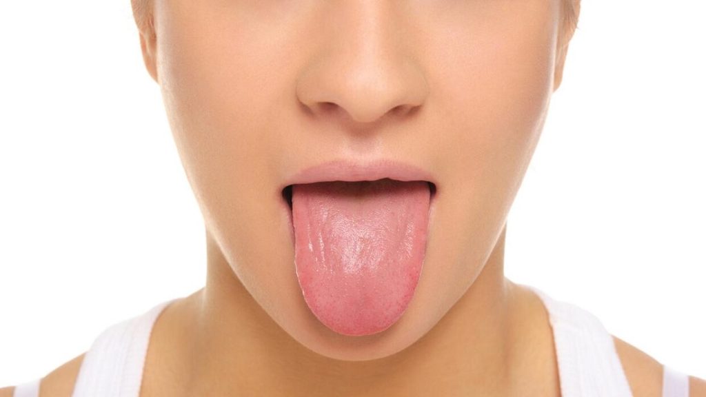 Qué es el cáncer de lengua