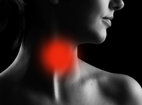 Qué es la adenopatía 1 Qué es la adenopatía