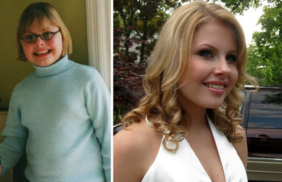 Ejemplos claros de que en algunos casos la pubertad hace maravillas