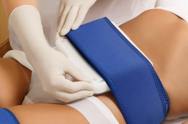 Así es la criolipólisis que hacen en Madrid para eliminar grasa sin cirugía