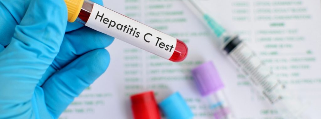 Cáncer de hígado: síntomas que te avisan del problema 64 hepatitis c test