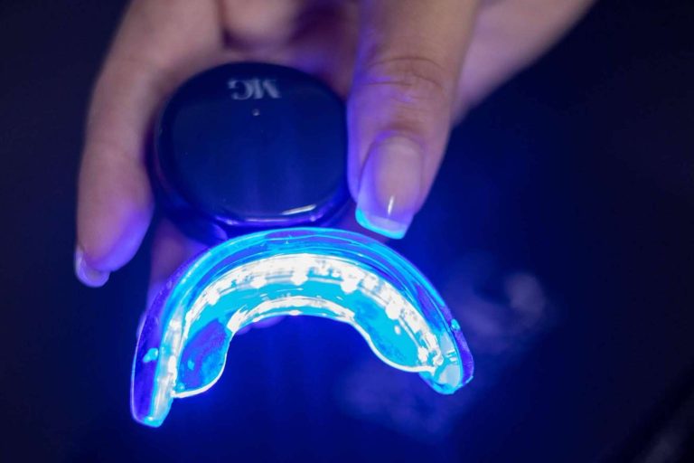La Clínica MG Dental & Estética Facial ofrece un tratamiento de blanqueamiento dental LED