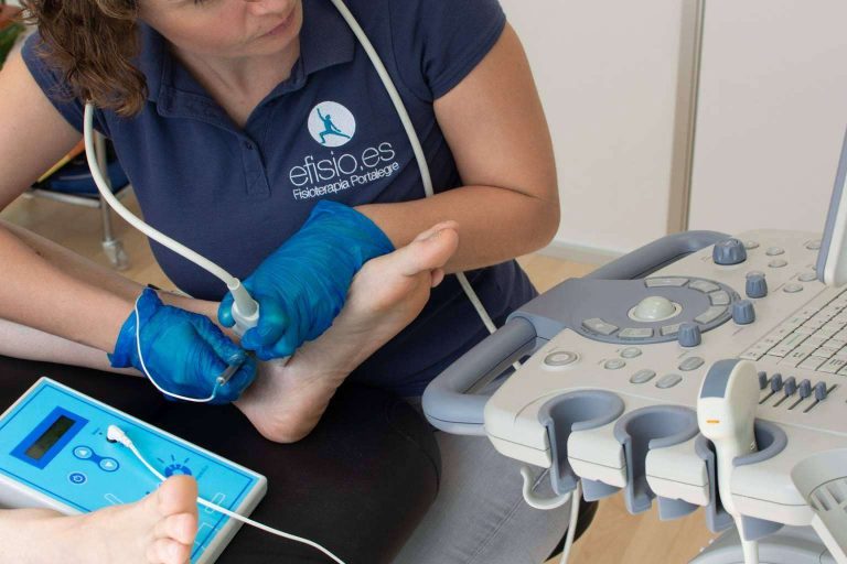 Efisio y su método para tratar fibrosis y tendinopatías