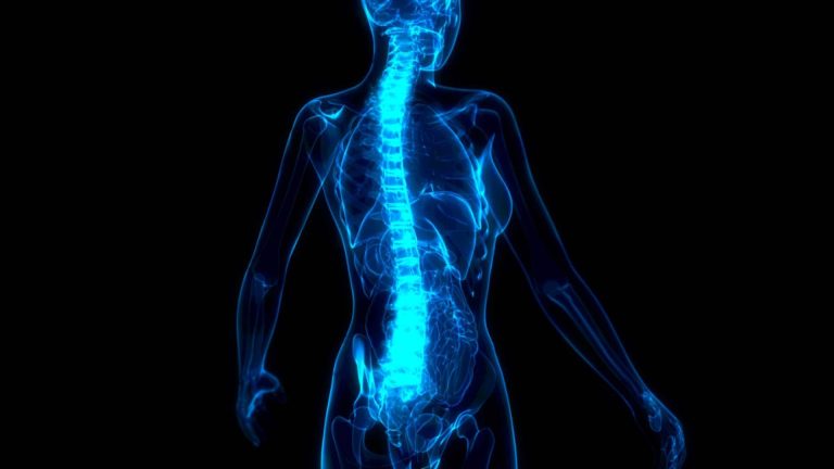 La rizólisis por radiofrecuencia para tratar el dolor lumbar y cervical