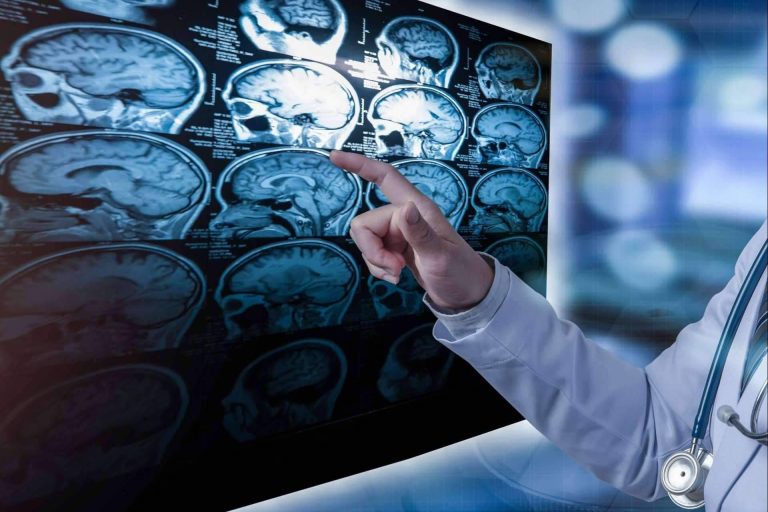 ¿Qué es la esclerosis múltiple?, por el centro especializado INIMA Rehabilitación