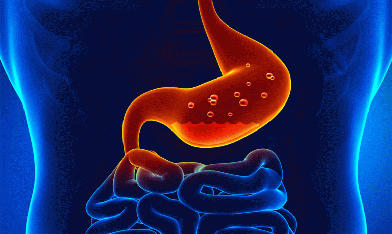 Alternativas naturales al omeprazol para no dañar tu estómago