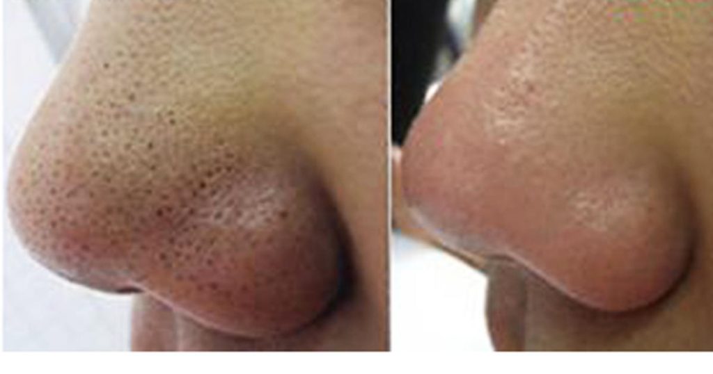 Todo pasa por una buena rutina de limpieza