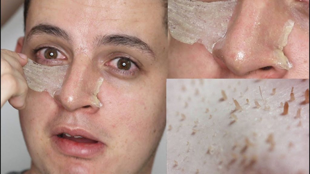 La mascarilla posterior