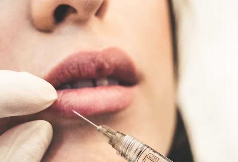 Botox en Madrid en la mejor clínica de medicina estética Dra. Elena Berezo