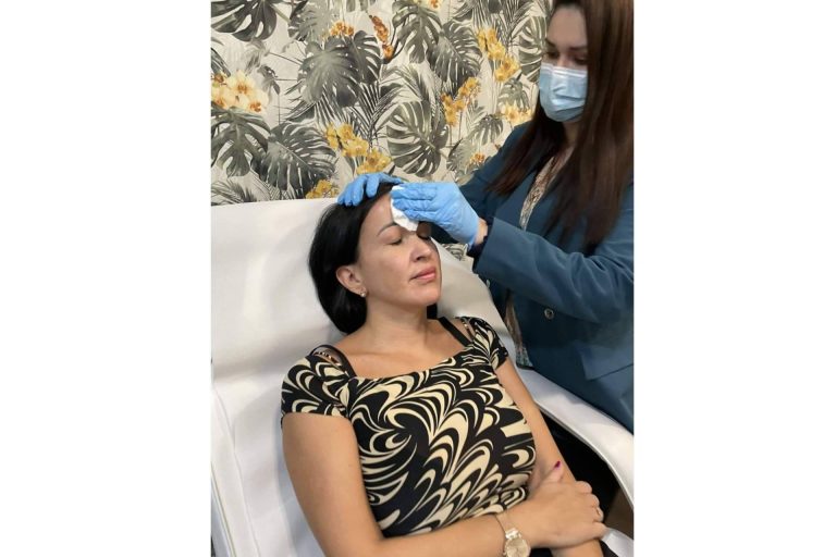 Qué es el peeling químico y qué beneficios tiene para la piel, con Cecilia Arthur