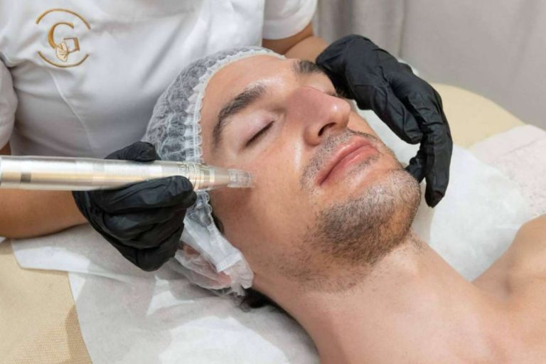 Tratamiento innovador Dermapen Madrid en G&G Beauty