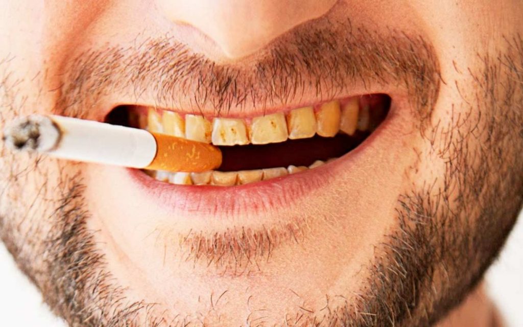 sonrisa con tabaco