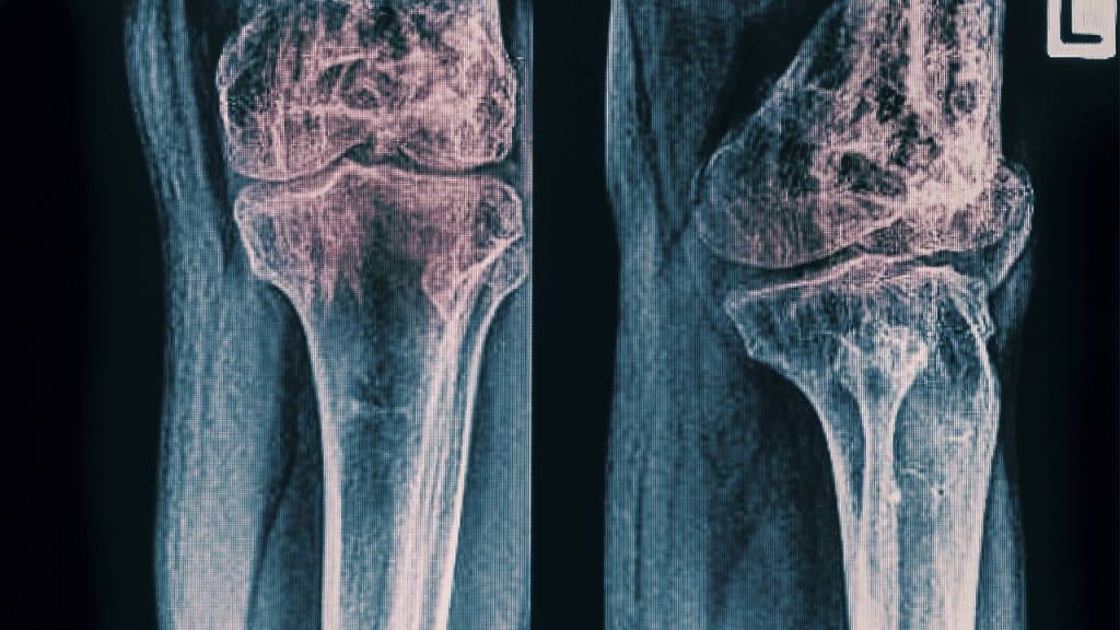 El inesperado uso médico de los mocos que entusiasma a los científicos