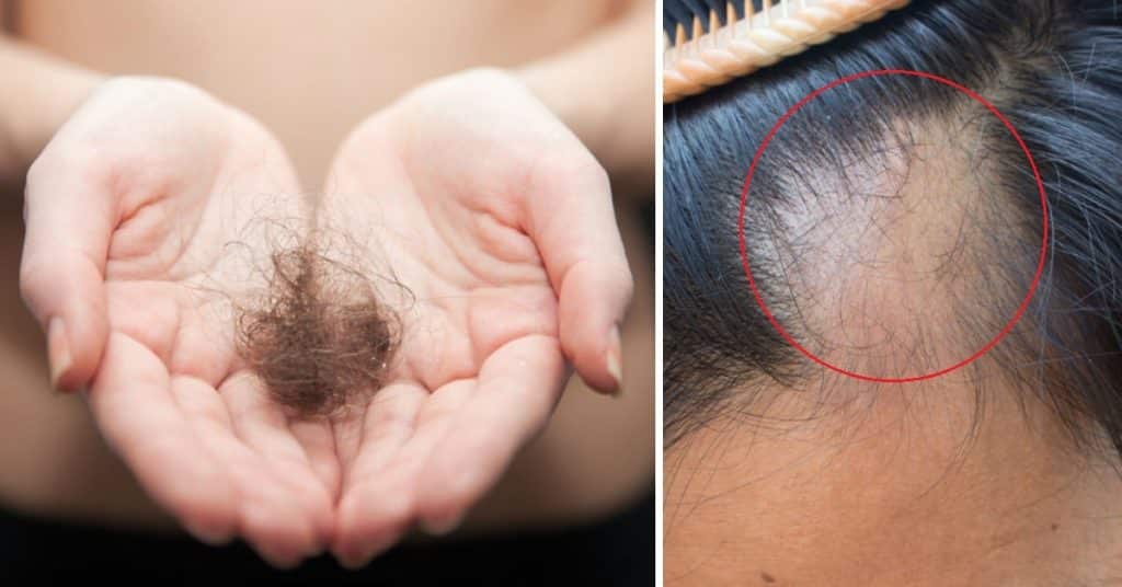 Generalmente no nos preocupamos por ello