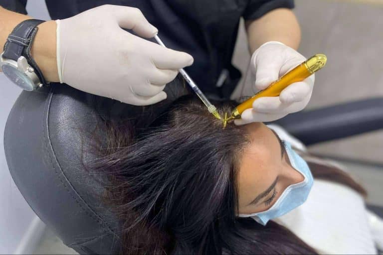 Servicio de injerto capilar en Alicante, con Élite Capilar