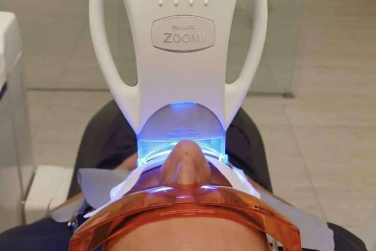 MYCA, la clínica que garantiza unos dientes blancos con la última tecnología