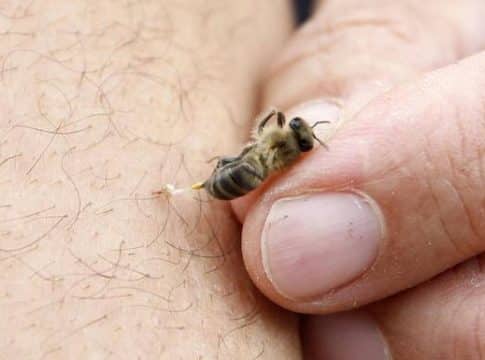 Cómo curar la picadura de una abeja