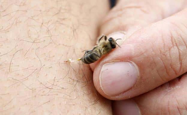 Cómo curar la picadura de una abeja