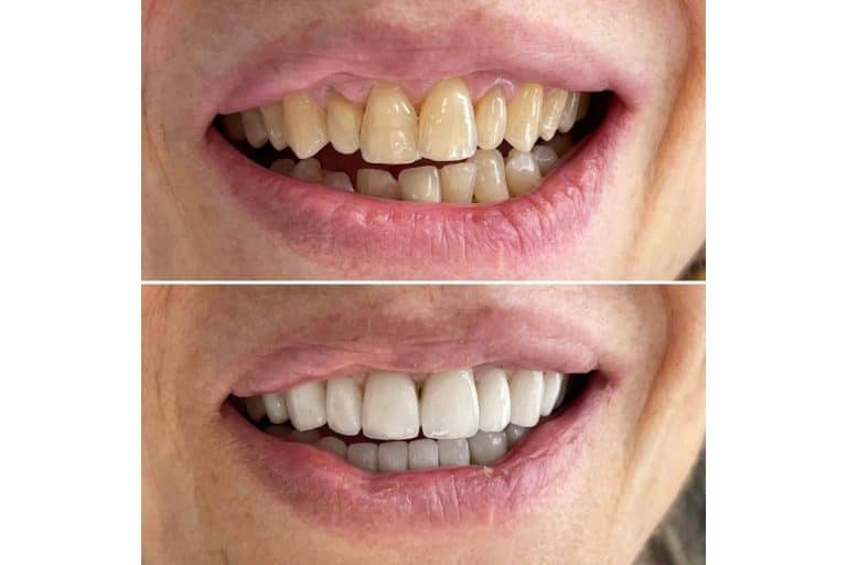 En Clínica MG Dental son expertos en estética dental