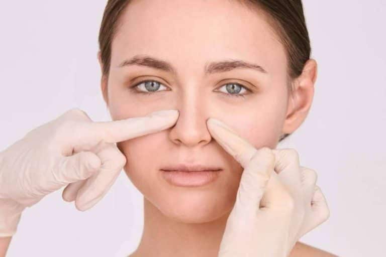 Armonizar la figura de la nariz sin cirugía es posible con la rinomodelación