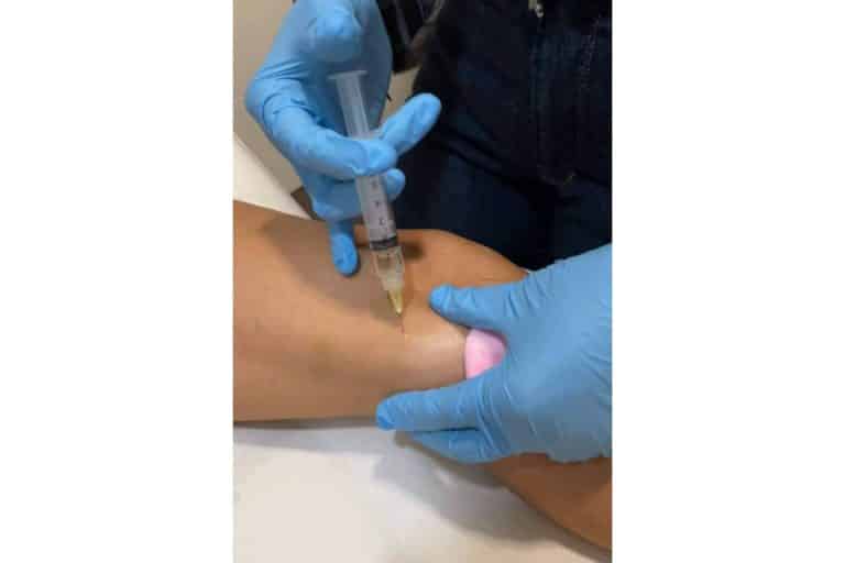 Las ventajas de mejorar la silueta con los tratamientos corporales de Cecilia Arthur