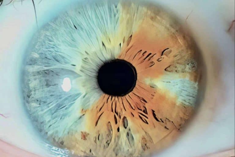 El gran libro Atlas sobre el cambio de color de ojos con láser, con Eyecos
