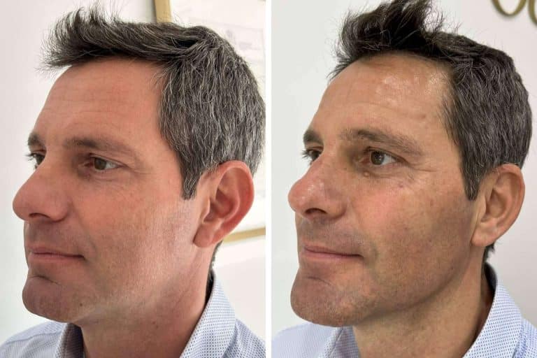 Mejorar la apariencia con los tratamientos faciales de Clínica VISO