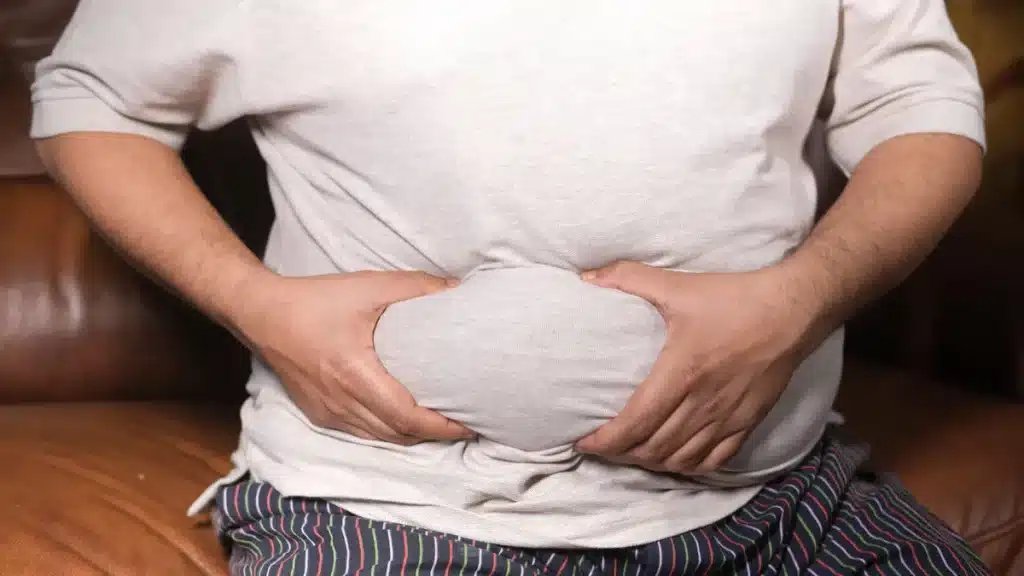 ¿Qué es ser obeso?