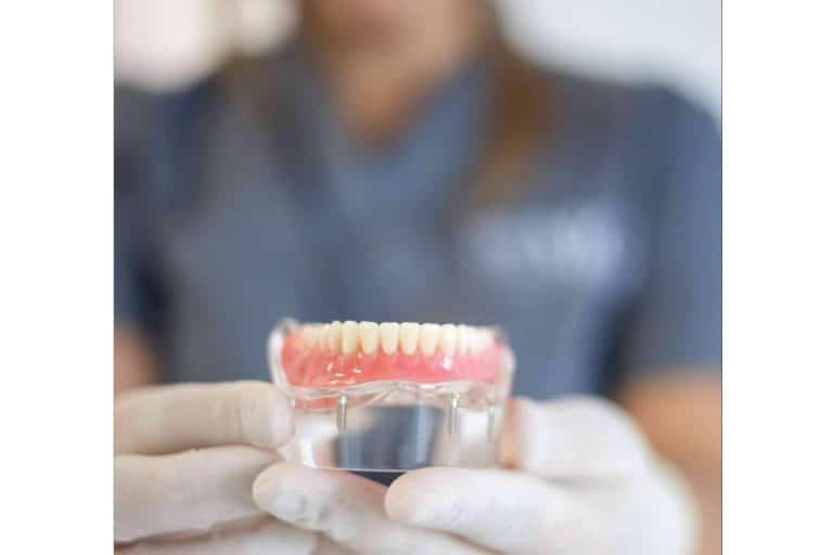 Especialistas en implantes dentales, Clínica MG Dental