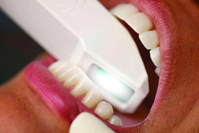 Instituto Odontológico Volpe sobre las claves y la importancia de la estética dental