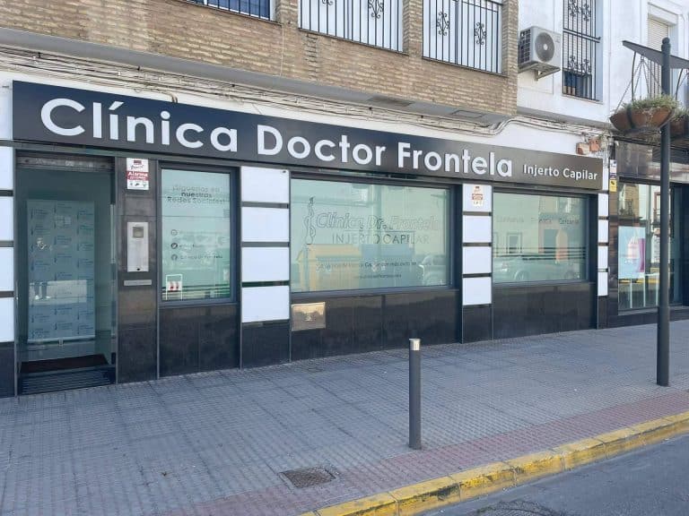Clínica injerto capilar Barcelona con la técnica FUE