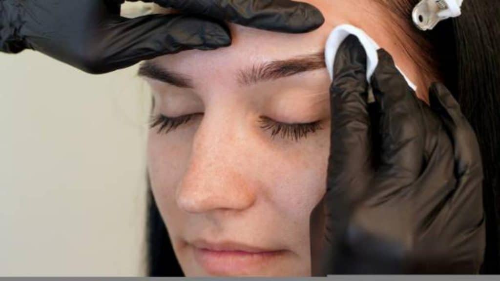 Consultar a un dermatólogo