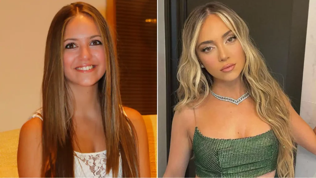 ¿Qué se pudo haber hecho en la nariz Ana Mena?