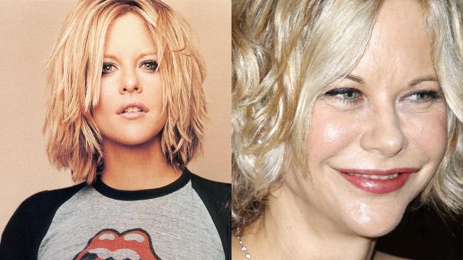 Meg Ryan y otros famosos irreconocibles tras hacerse una cirugía