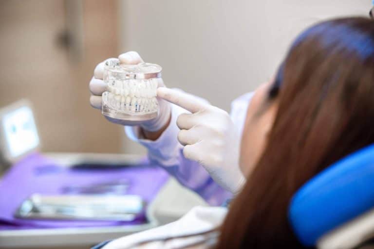 Implantes a medida con materiales de calidad en la clínica dental Samprodent; una solución personalizada para cada paciente