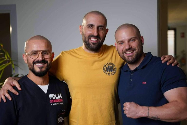 La micropigmentación capilar, y Aldemar Campos