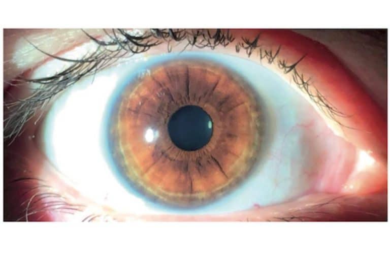 Clínica Eyecos informa de que los productos crece pestañas pueden oscurecer los ojos