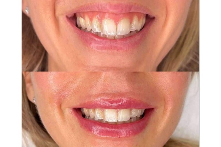 ¿En qué consiste la cirugía ortognática?, por Clínica Calvo de Mora