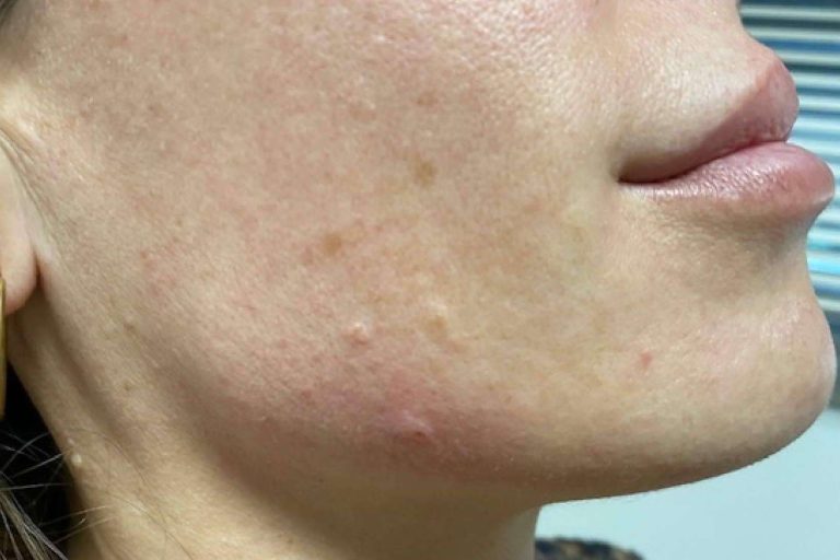 Clínica Amalfi ofrece un tratamiento facial completo para mejorar el aspecto de la piel