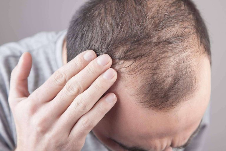 Tratamientos destacados de medicina capilar, de la mano de Hospital de La Reina