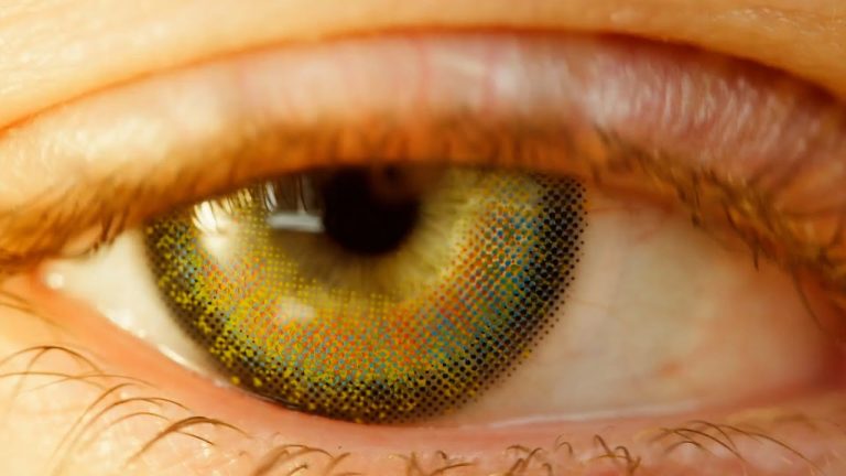 Una operación para cambiar el color de tus ojos