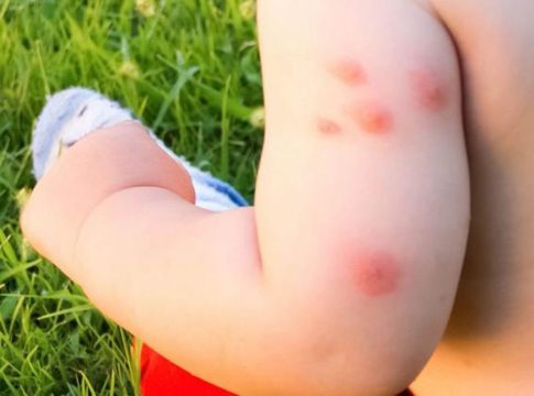 Cuales-son-los-mejores-productos-contra-los-mosquitos-segun-la-OCU-6