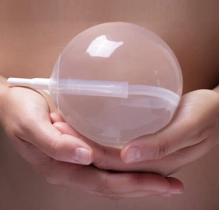 Pierde peso de manera más rápida con el balón gástrico