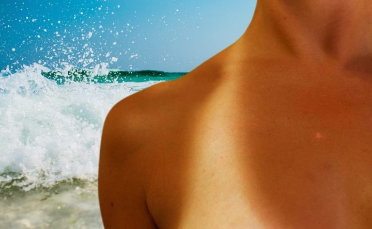 Remedios caseros para no tener marcas del bikini al tomar el sol