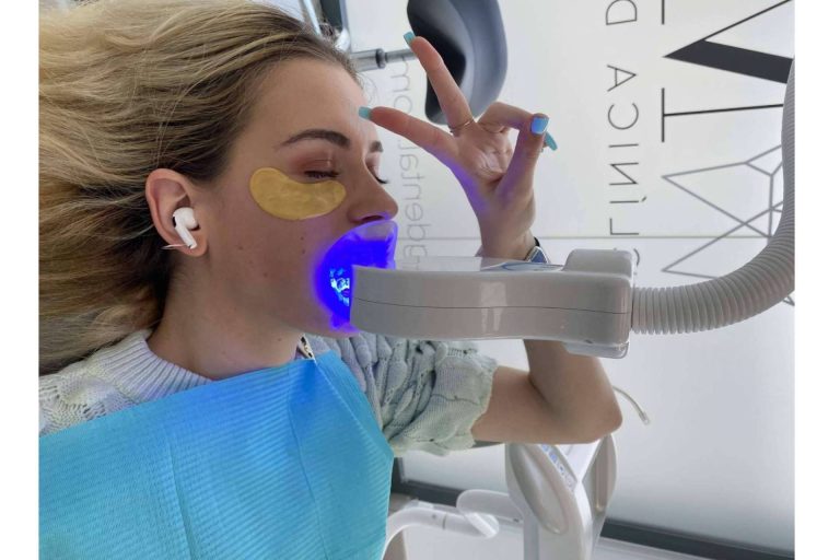 Conseguir una sonrisa radiante en una sesión con el blanqueamiento dental LED en Clínica MG Dental