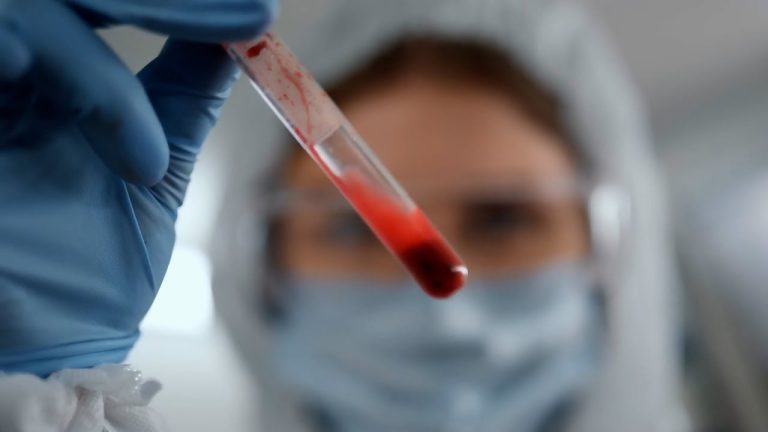 Existe la sangre dorada