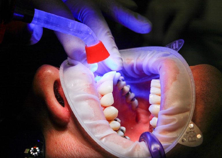 La importancia de la salud bucodental en México