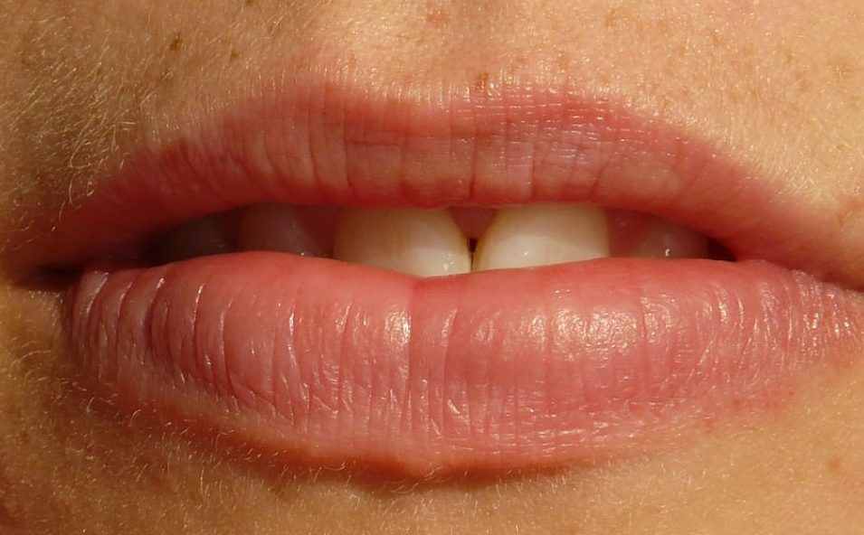 Labios resecos y agrietados Consigue labios hidratados y tentadores este verano